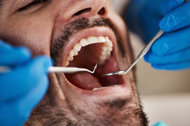 Best Emergency Treatment for Dental Infections or Abscesses in Monroeville, PA